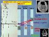 Slide11